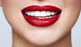 Важное о винирах  В каких случаях они применяются : некрасивая форма зубов; наличи